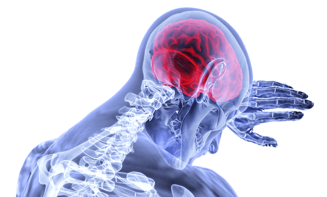 stroke during sex